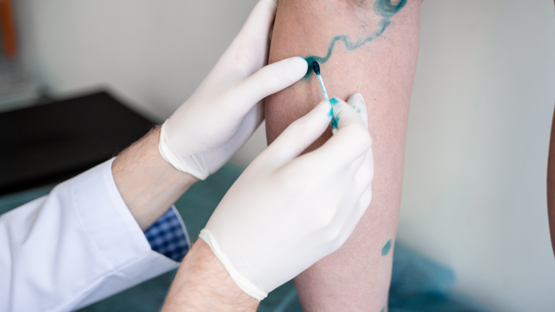 Chirurgie Vasculară: Intervenții sigure și eficiente pentru sănătatea vaselor de sânge